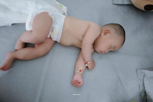 淮北六个月宝宝眼睛散光